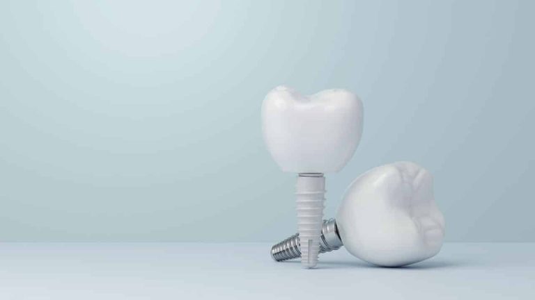 What Is Implant Treatment? In Which Situations Is It Applied?