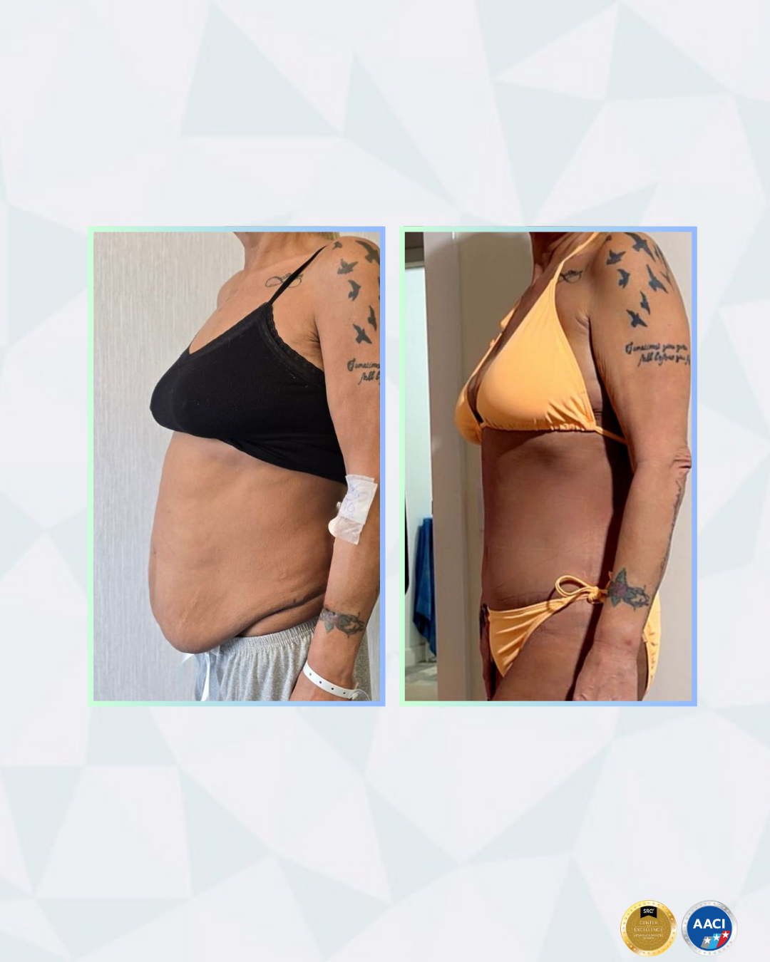 Emma L. transformation