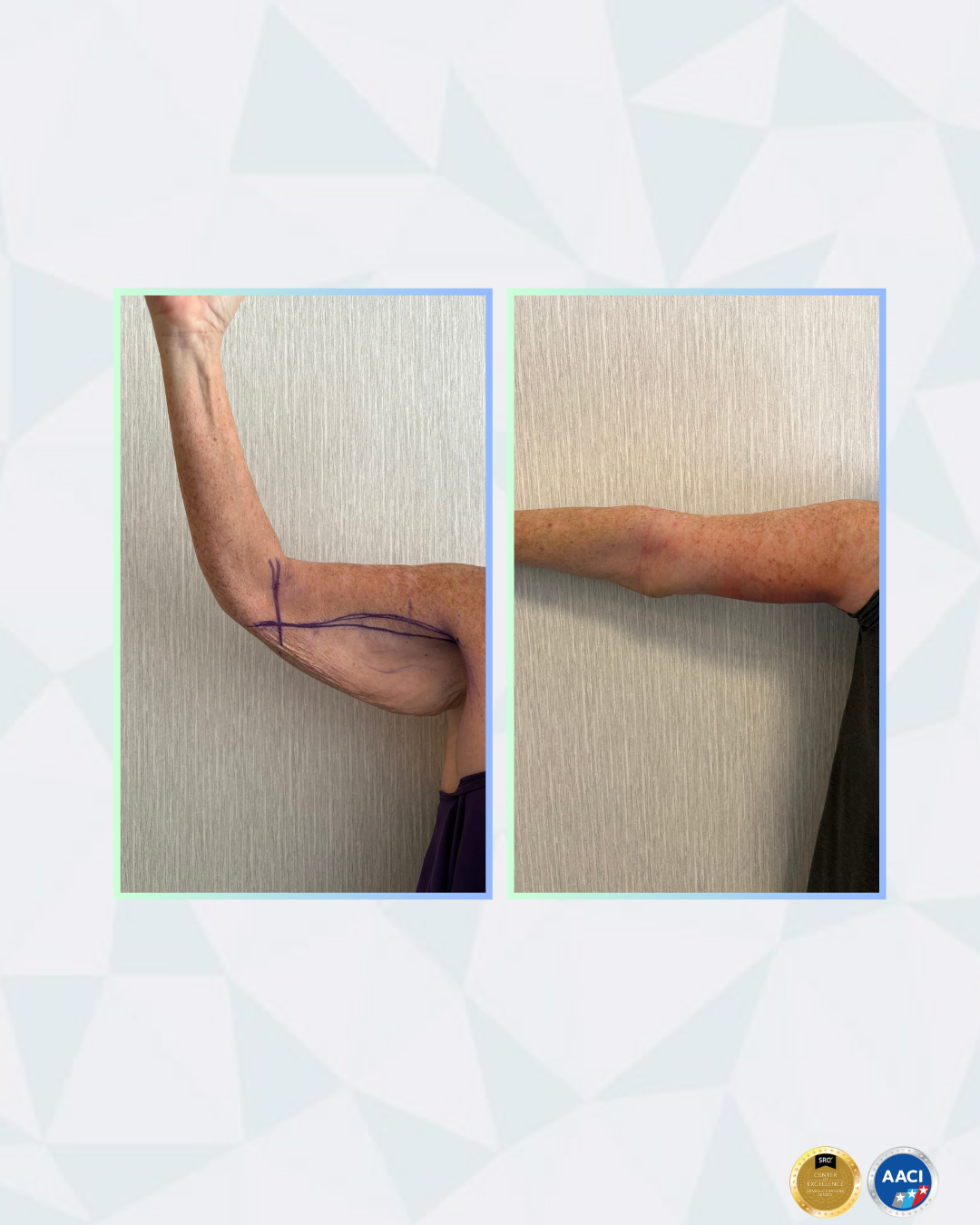 Jessica R. transformation
