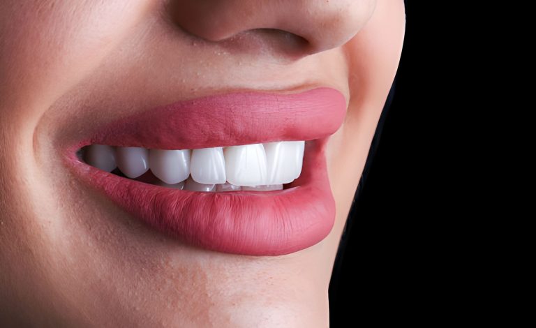 Zirconia Crowns and Porcelain Veneers in Turkey: What Are the Differences?