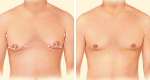 Male2